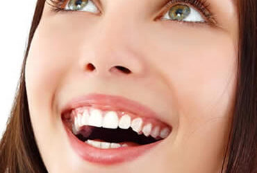 Who Can Benefit from Dental Veneers?