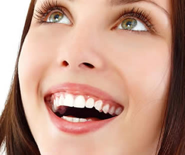 Who Can Benefit from Dental Veneers?