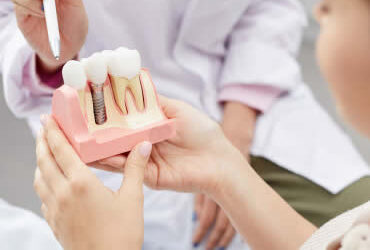 An Introduction to Dental Implants