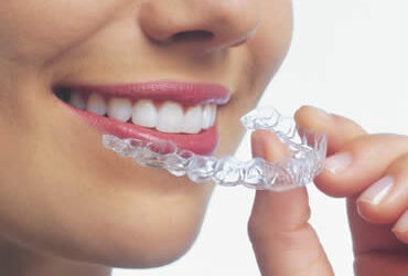 Invisalign for Children: Is It a Good Fit?