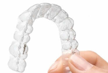 Unlocking Your Best Smile with Invisalign