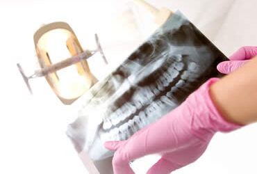 Corrective Jaw Surgery: What You Need to Know