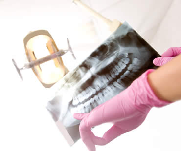 Corrective Jaw Surgery: What You Need to Know
